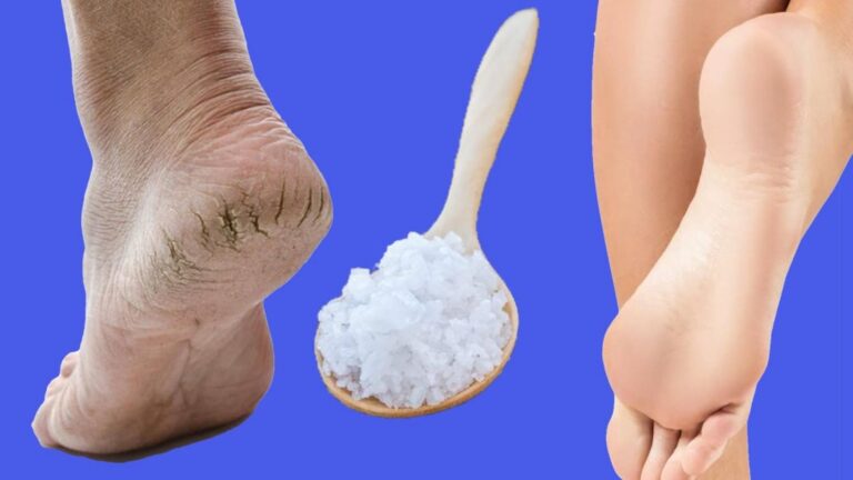 This simple trick transforms cracked heels into soft, baby-like feet …