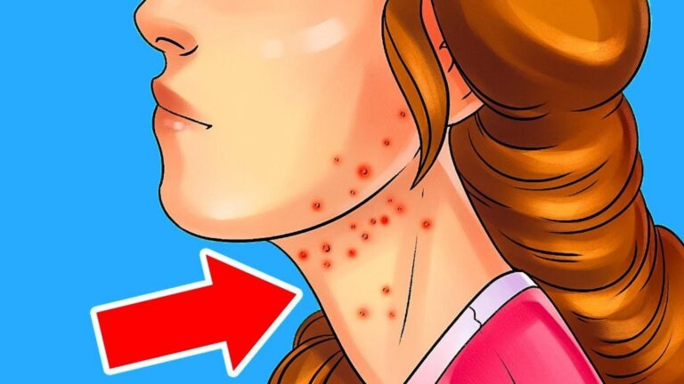 This common sign could mean diabetes is lurking… recognize it before it’s too late!