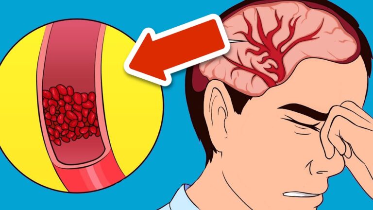 7 Quick Tips to Cure Migraines Instantly and Easily