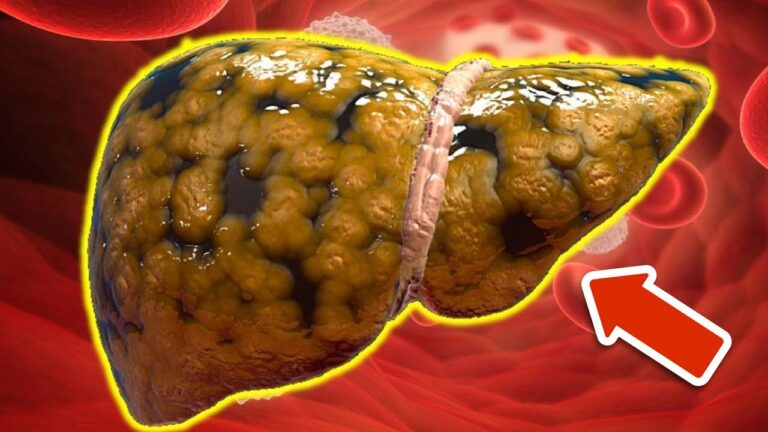 6 Superfoods to Detox Your Liver Naturally and Effectively!