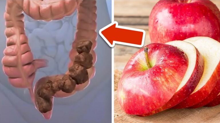 6 Foods to Clean Your Colon: Discover 5 Surprisingly Effective Choices!