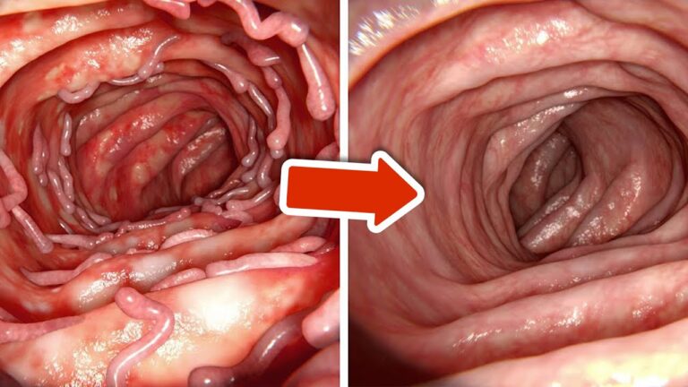Clean Your Colon Naturally: 5 Quick Methods for a Healthier You!
