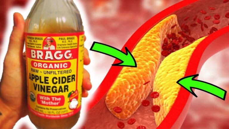 7 Ways Apple Cider Vinegar Cleanses Clogged Arteries for Better Health