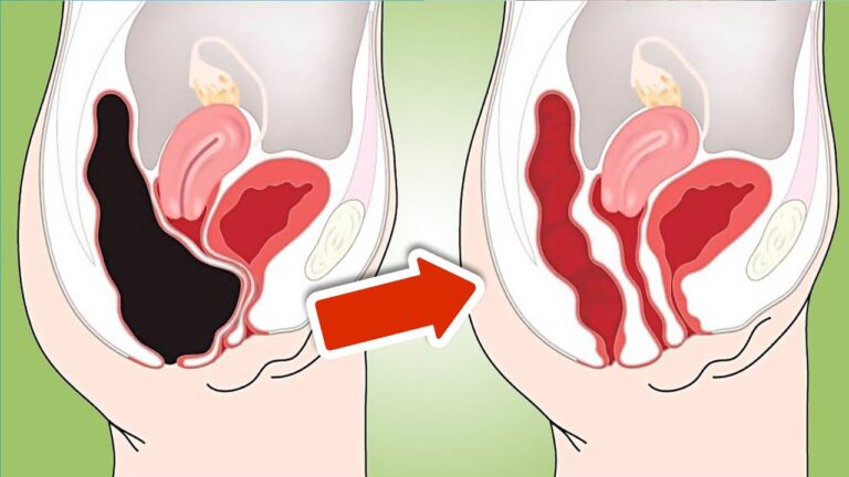 7 Surprising Home Remedies for Natural Gut Cleansing You Can Try Today!