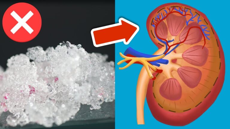 5 Easy Ways to Naturally Cleanse Your Kidneys for Better Health!