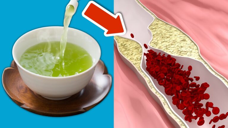 Clean Your Arteries with 5 Simple Green Tea Tips That Always Work!