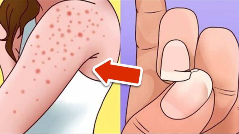 8 Warning Signs of Gluten Intolerance You Should Never Ignore!