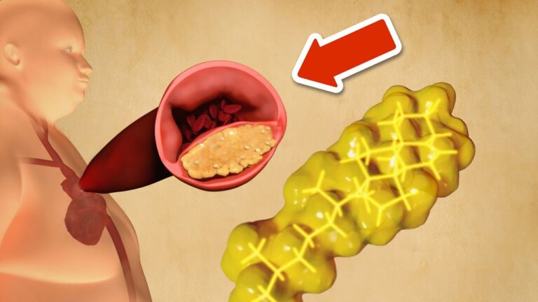 Lower Your Cholesterol: 6 Simple Ways Without Meds You Need to Try!