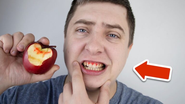 7 Home Remedies to Stop Gum Bleeding for Healthy Smiles You Need to Try!