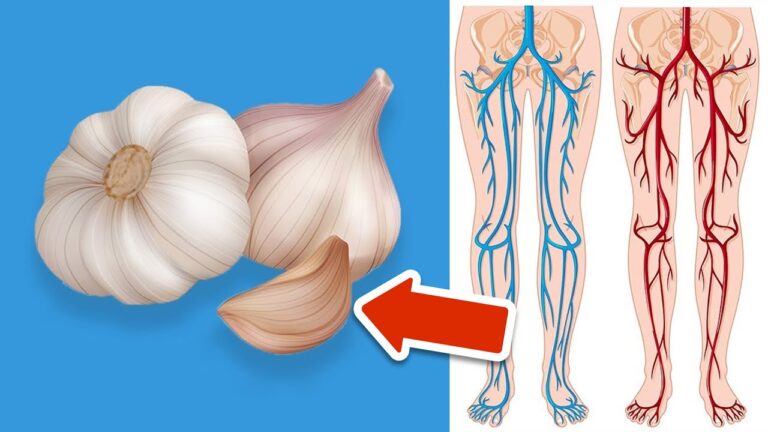 Transform Your Body: 7 Surprising Benefits of Eating Garlic for Just One Week!