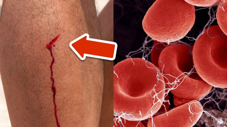 7 Warning Signs of Blood Clots You Need to Know Now!