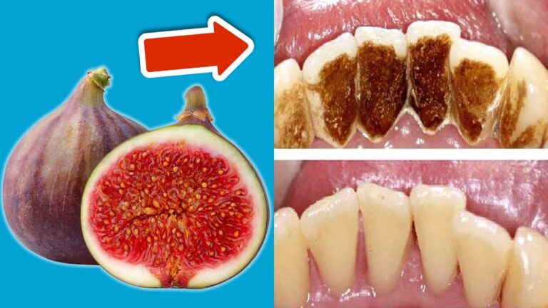 Remove Tooth Plaque: 5 Simple Solutions You Need to Try Now! 💥