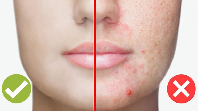 5 Daily Habits Destroying Your Skin – Avoid These for a Radiant Glow!