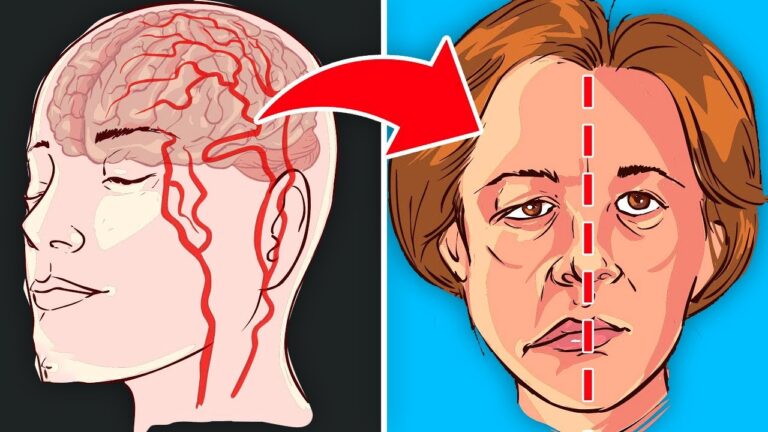 9 Foods You Should Eat to Prevent Stroke and Boost Your Health Today!