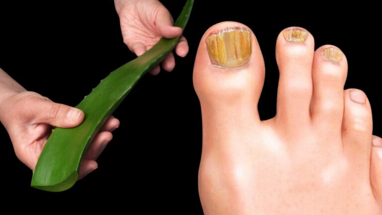 Discover 5 Healing Benefits of This Miracle Plant for Your Health