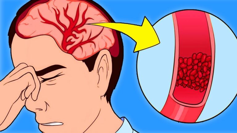 7 Warning Signs You Have High Blood Pressure You Shouldn’t Ignore!